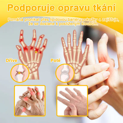 BSWELL® krém s včelím jedem pro regeneraci kloubů 🏃‍♀️ (extrakt z novozélandských včel – vyvinutý speciálně pro lidi s problémy s klouby a bolestí kloubů)