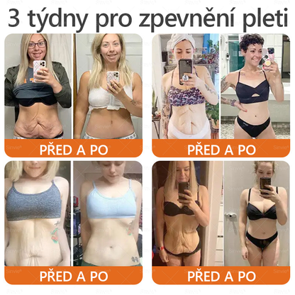 🌿 Sinvie® Krém na obnovu pleti s včelím jedem(👨‍⚕‍CE schváleno)