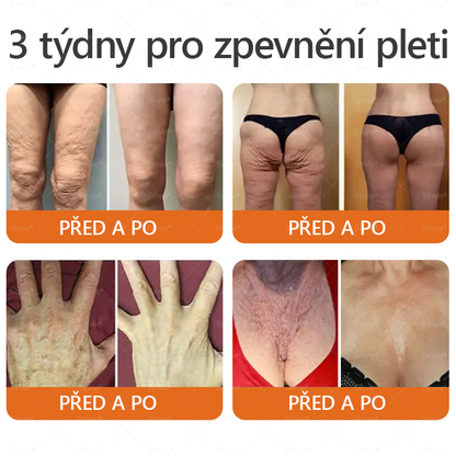 💟Doporučení dermatologa 🐝 ✨Sinvie® Krém na obnovu pleti s včelím jedem 🔥 Český vývoj, výroba a dodávka v České republice