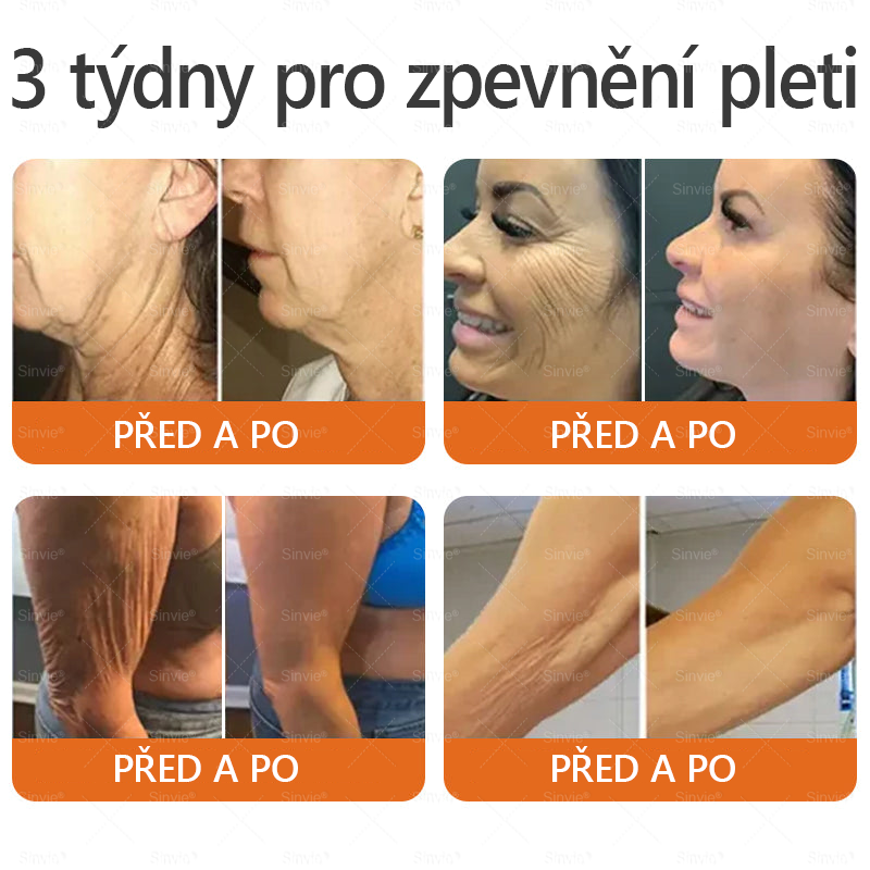 🏆⭐Doporučení dermatologa 🐝 ✨Sinvie® Krém na obnovu pleti s včelím jedem 🔥 Český vývoj, výroba a dodávka v České republice