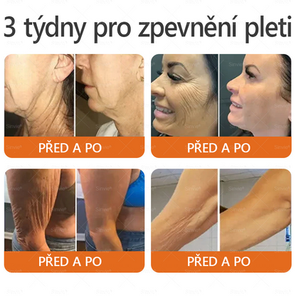 🏆⭐Doporučení dermatologa 🐝 ✨Sinvie® Krém na obnovu pleti s včelím jedem 🔥 Český vývoj, výroba a dodávka v České republice