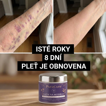 🪻 100 000+ PRODANÝCH KUSŮ 💁‍♀️ – PuraCure® Krém na modřiny a posílení pokožky