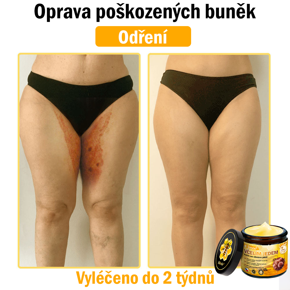 🌿 Sinvie® Krém na obnovu pleti s včelím jedem(👨‍⚕‍CE schváleno)
