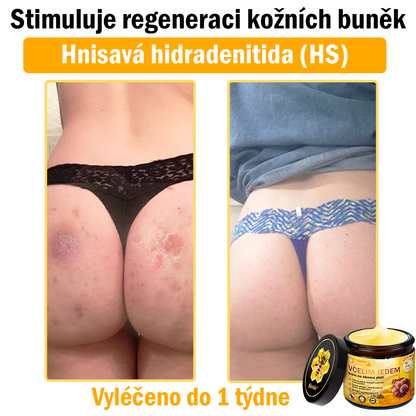 💝🌹 Sinvie® Krém na obnovu pleti s včelím jedem 👨‍⚕‍CE schváleno