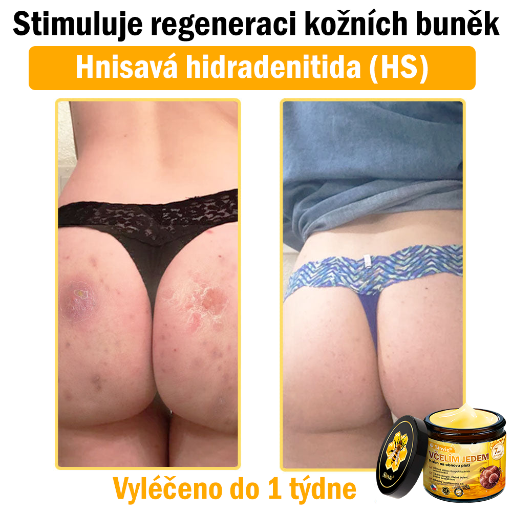 🌿 Sinvie® Krém na obnovu pleti s včelím jedem(👨‍⚕‍CE schváleno)