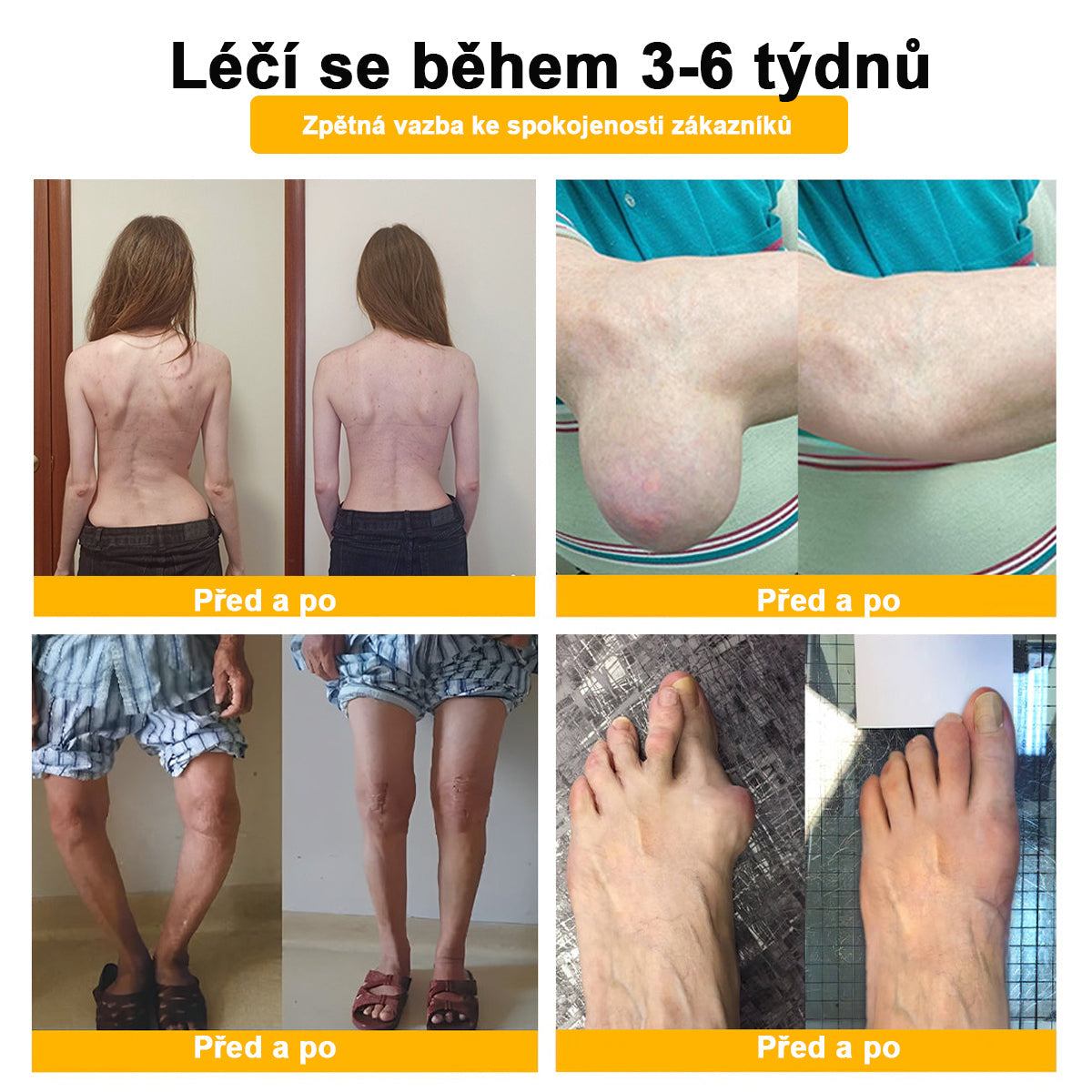 BSWELL® krém s včelím jedem pro regeneraci kloubů 🏃‍♀️ (extrakt z novozélandských včel – vyvinutý speciálně pro lidi s problémy s klouby a bolestí kloubů)