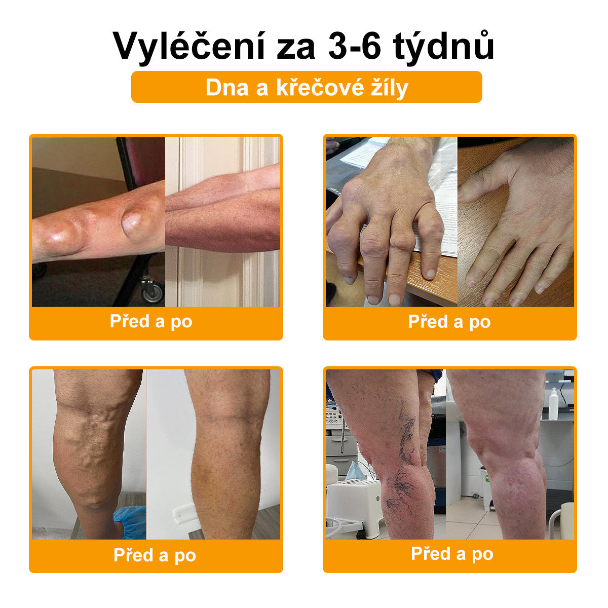 BSWELL® krém s včelím jedem pro regeneraci kloubů 🏃‍♀️ (extrakt z novozélandských včel – vyvinutý speciálně pro lidi s problémy s klouby a bolestí kloubů)