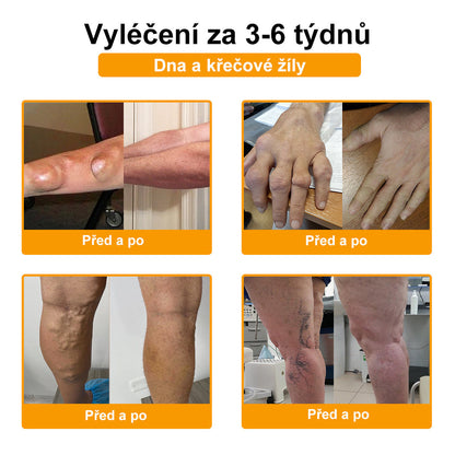 BSWELL® krém s včelím jedem pro regeneraci kloubů 🏃‍♀️ (extrakt z novozélandských včel – vyvinutý speciálně pro lidi s problémy s klouby a bolestí kloubů)