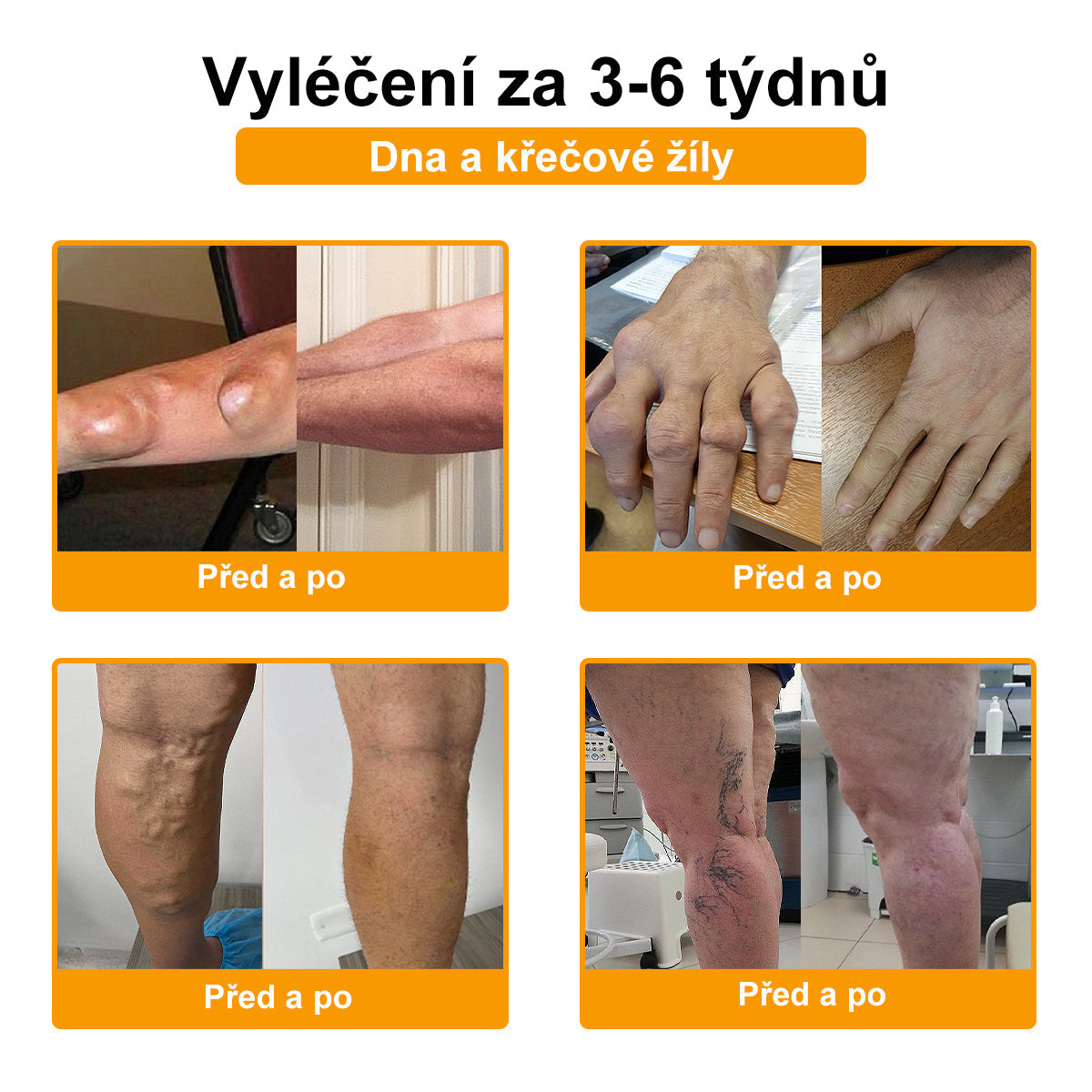 BSWELL® krém s včelím jedem pro regeneraci kloubů 🏃‍♀️ (extrakt z novozélandských včel – vyvinutý speciálně pro lidi s problémy s klouby a bolestí kloubů)
