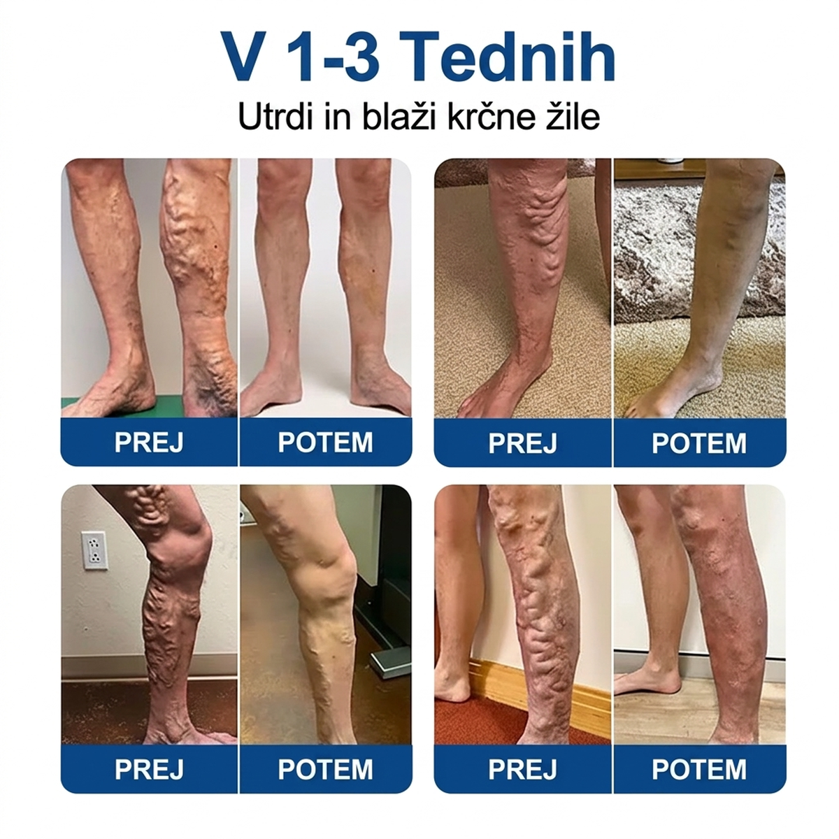 🌱 Medistart® Mikroiglični obliž za nego krčnih žil ⚡ Takojšnje olajšanje, dolgotrajni učinki