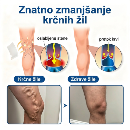 🌱 Medistart® Mikroiglični obliž za nego krčnih žil ⚡ Takojšnje olajšanje, dolgotrajni učinki