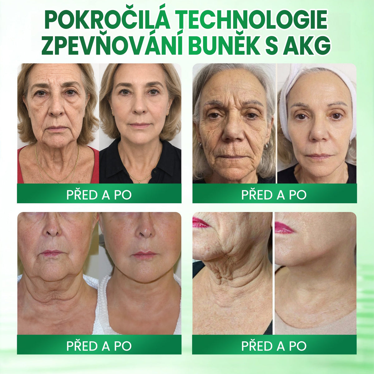 💳Medistart® AKG ZPEVŇUJÍCÍ PÉČE O PLEŤ & PROTI STÁRNUTÍ