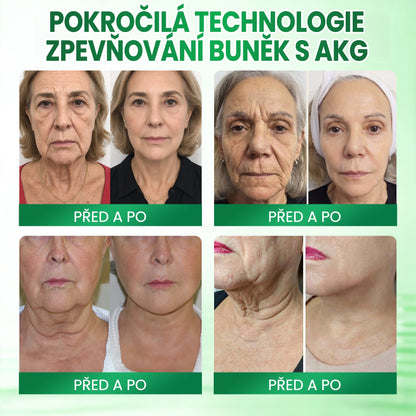💳Medistart® AKG ZPEVŇUJÍCÍ PÉČE O PLEŤ & PROTI STÁRNUTÍ