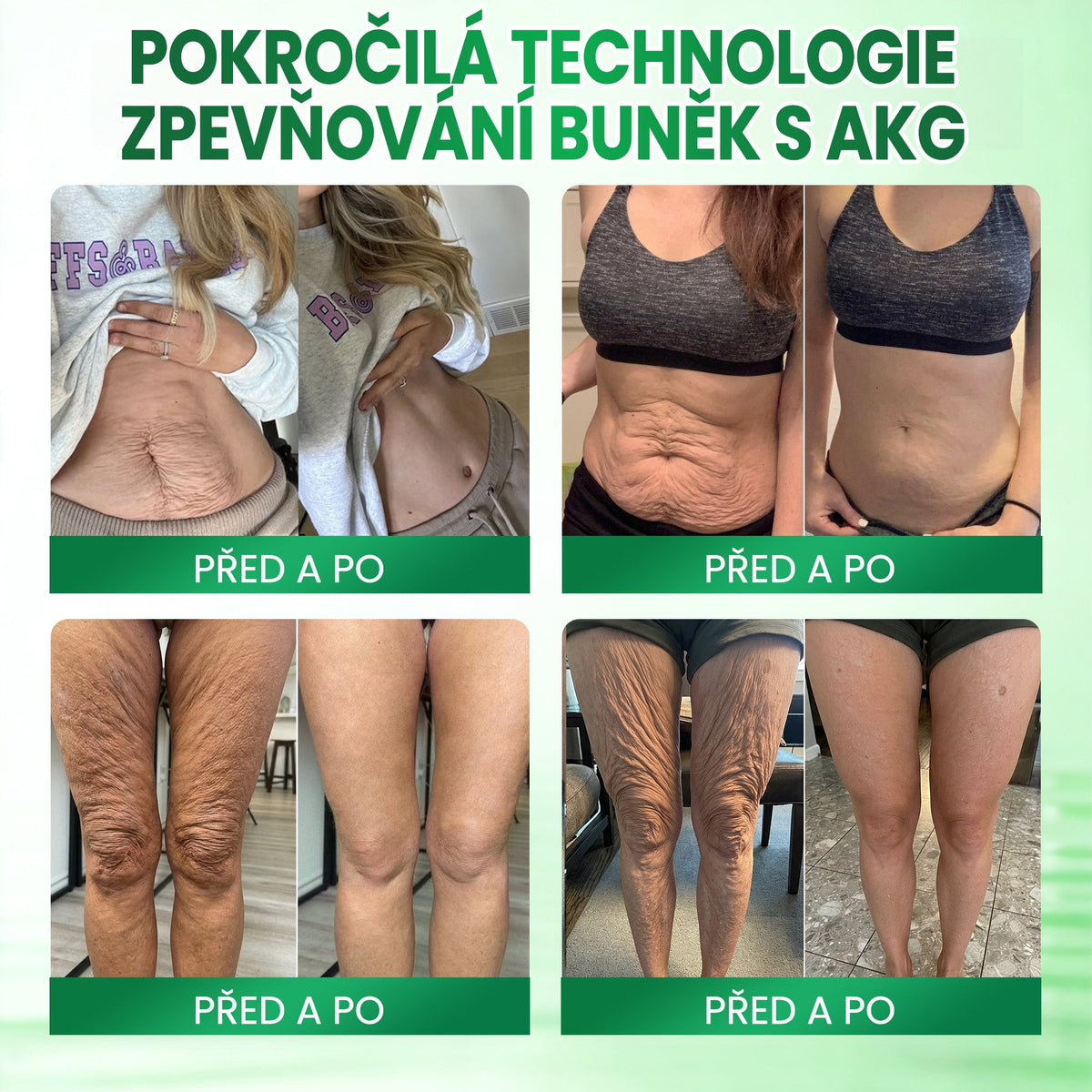 💳Medistart® AKG ZPEVŇUJÍCÍ PÉČE O PLEŤ & PROTI STÁRNUTÍ