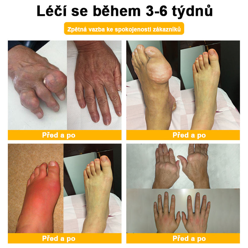 BSWELL® krém s včelím jedem pro regeneraci kloubů 🏃‍♀️ (extrakt z novozélandských včel – vyvinutý speciálně pro lidi s problémy s klouby a bolestí kloubů)