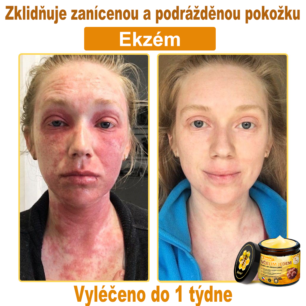 👍🐝 Sinvie® Krém na obnovu pleti s včelím jedem(👨‍⚕‍CE certifikace)👍✅
