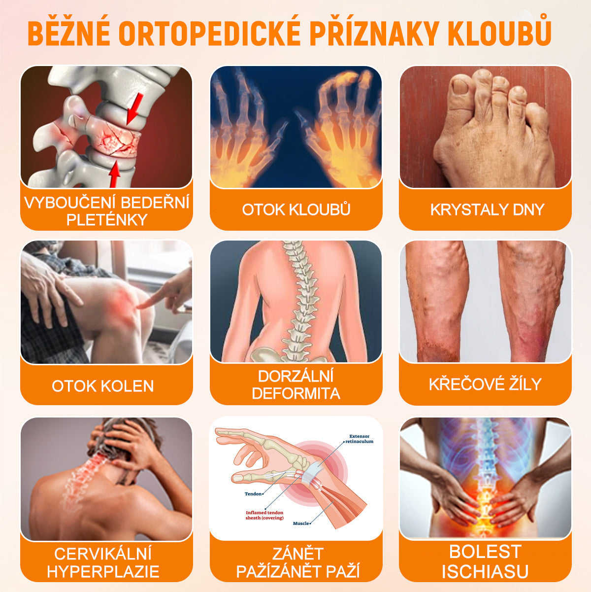 BSWELL® krém s včelím jedem pro regeneraci kloubů 🏃‍♀️ (extrakt z novozélandských včel – vyvinutý speciálně pro lidi s problémy s klouby a bolestí kloubů)