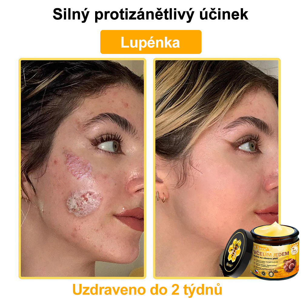 👍🐝 Sinvie® Krém na obnovu pleti s včelím jedem(👨‍⚕‍CE certifikace)👍✅
