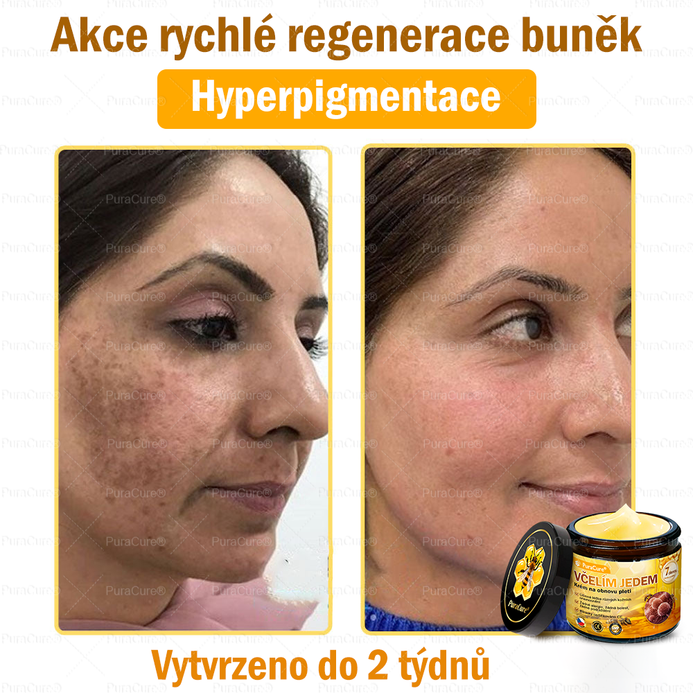 🛡️Doporučení dermatologa 🐝 ✨PuraCure® Krém na obnovu pleti s včelím jedem 🔥 Český vývoj, výroba a dodávka v České republice