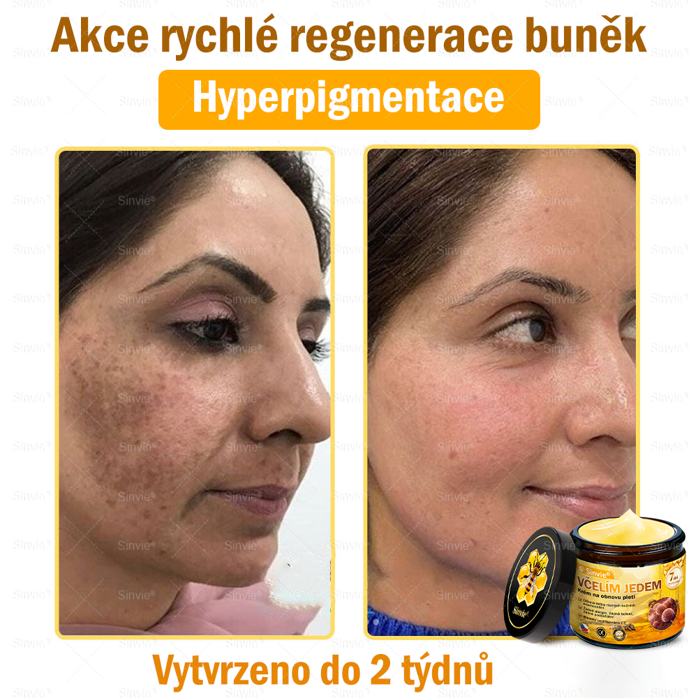 ✅Doporučení dermatologa 🐝 ✨Sinvie® Krém na obnovu pleti s včelím jedem 🔥 Český vývoj, výroba a dodávka v České republice