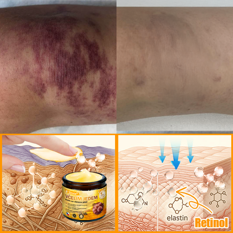 👍🐝 Sinvie® Krém na obnovu pleti s včelím jedem(👨‍⚕‍CE certifikace)👍✅