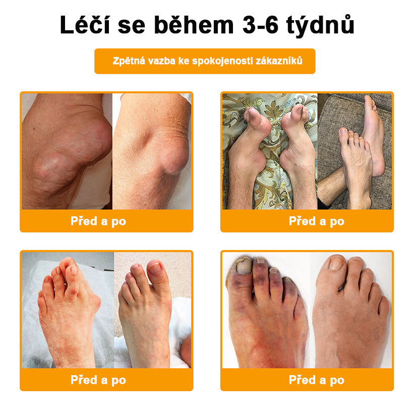 BSWELL® krém s včelím jedem pro regeneraci kloubů 🏃‍♀️ (extrakt z novozélandských včel – vyvinutý speciálně pro lidi s problémy s klouby a bolestí kloubů)