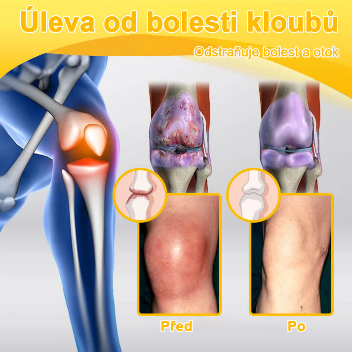 BSWELL® krém s včelím jedem pro regeneraci kloubů 🏃‍♀️ (extrakt z novozélandských včel – vyvinutý speciálně pro lidi s problémy s klouby a bolestí kloubů)