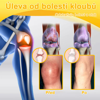 BSWELL® krém s včelím jedem pro regeneraci kloubů 🏃‍♀️ (extrakt z novozélandských včel – vyvinutý speciálně pro lidi s problémy s klouby a bolestí kloubů)