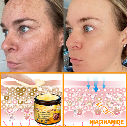 👍🐝 Sinvie® Krém na obnovu pleti s včelím jedem(👨‍⚕‍CE certifikace)👍✅