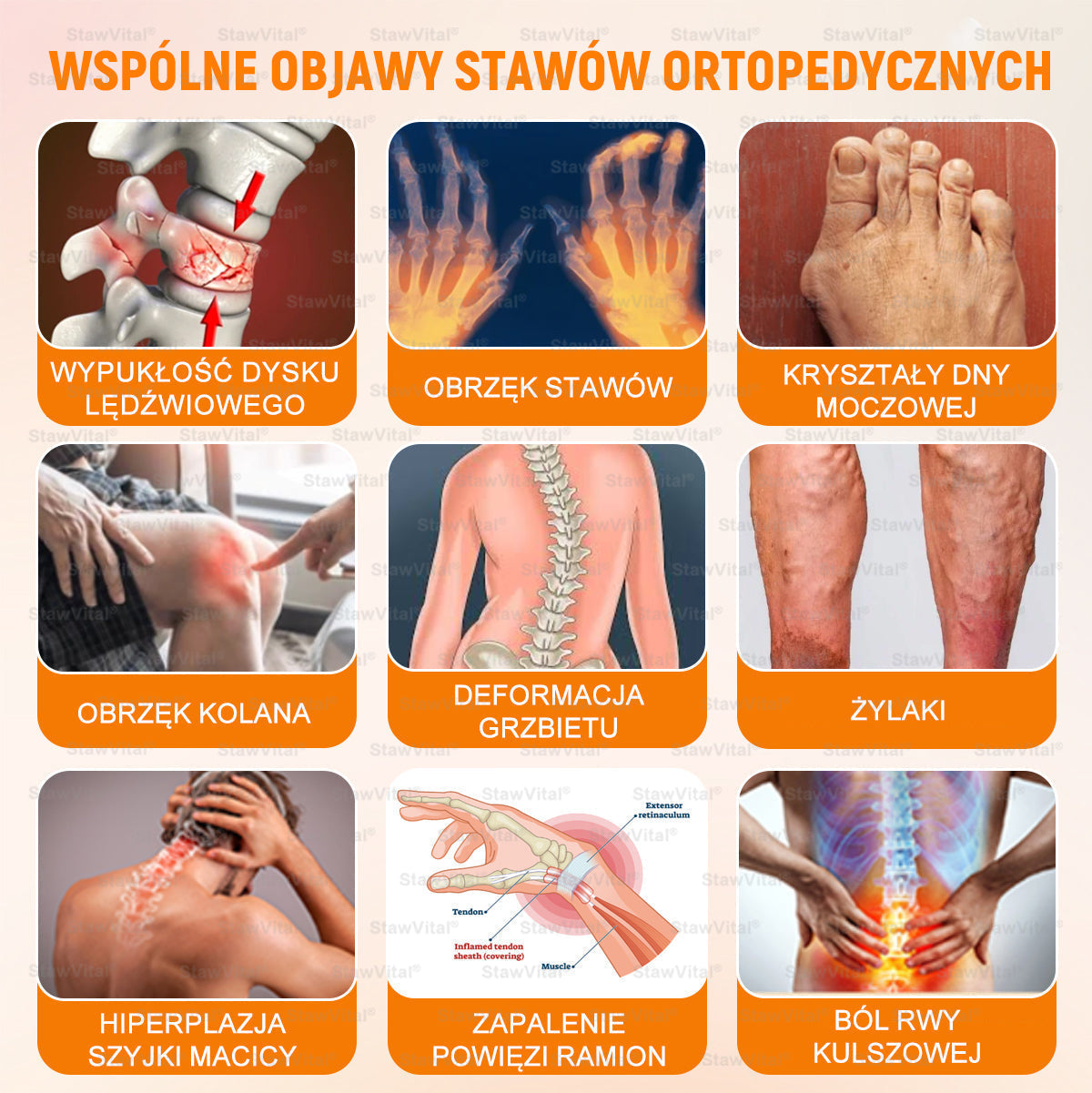 BSWELL® Krem z jadem pszczelim na regenerację stawów 🏃‍♀️ (ekstrakt z pszczoły nowozelandzkiej – opracowany z myślą o osobach z problemami ze stawami i bólem stawów)